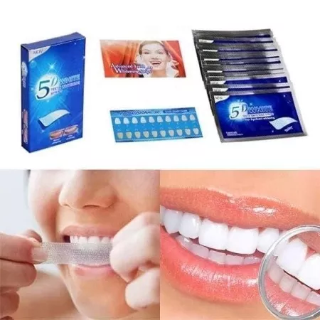 لاصقات تبيض الأسنان  
