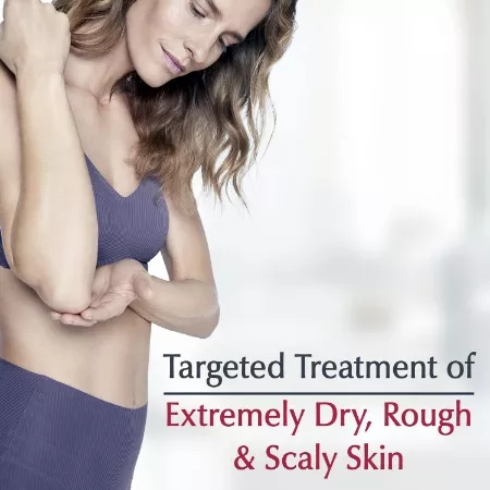 Eucerin Roughness Relief Spot Treatment