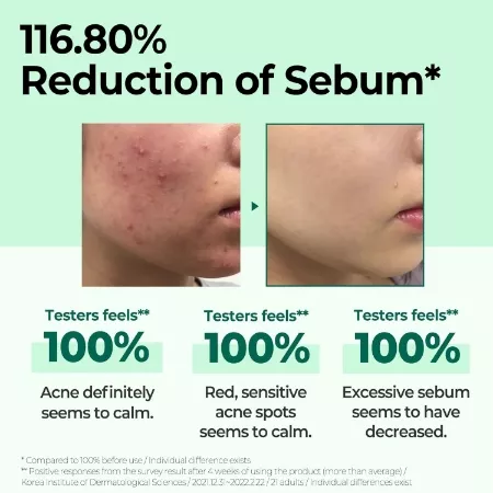Some By Mi 30 Days Miracle Toner