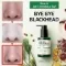Say Goodbye to Blackheads in 30 Days! Miracle Green Tea Tox Bubble Cleanser