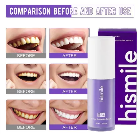 hismile color corrector serum