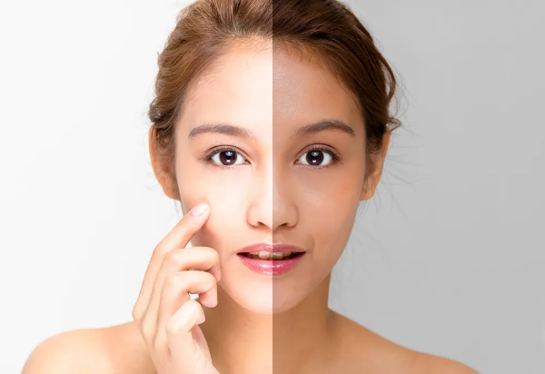 Picture for category Face whitening products