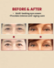 Picture of SEOUL 1988 Eye Cream: Discover the Transformative Power of Retinal for Youthful Eyes