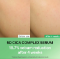 صورة سيرم Torriden Balanceful Cica Serum: سر الجمال الطبيعي لبشرة صحية ومشرقة
