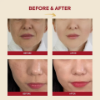 seoul 1988  Essance snail mucin 93 + rice 100