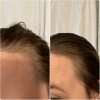 Picture of The Ordinary Multi-Peptide Hair Serum 30 ml  | Hair Density Support
