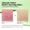 anua soothing pad