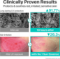 numbuzin pantothenic b5 hyaluronic active clear mask